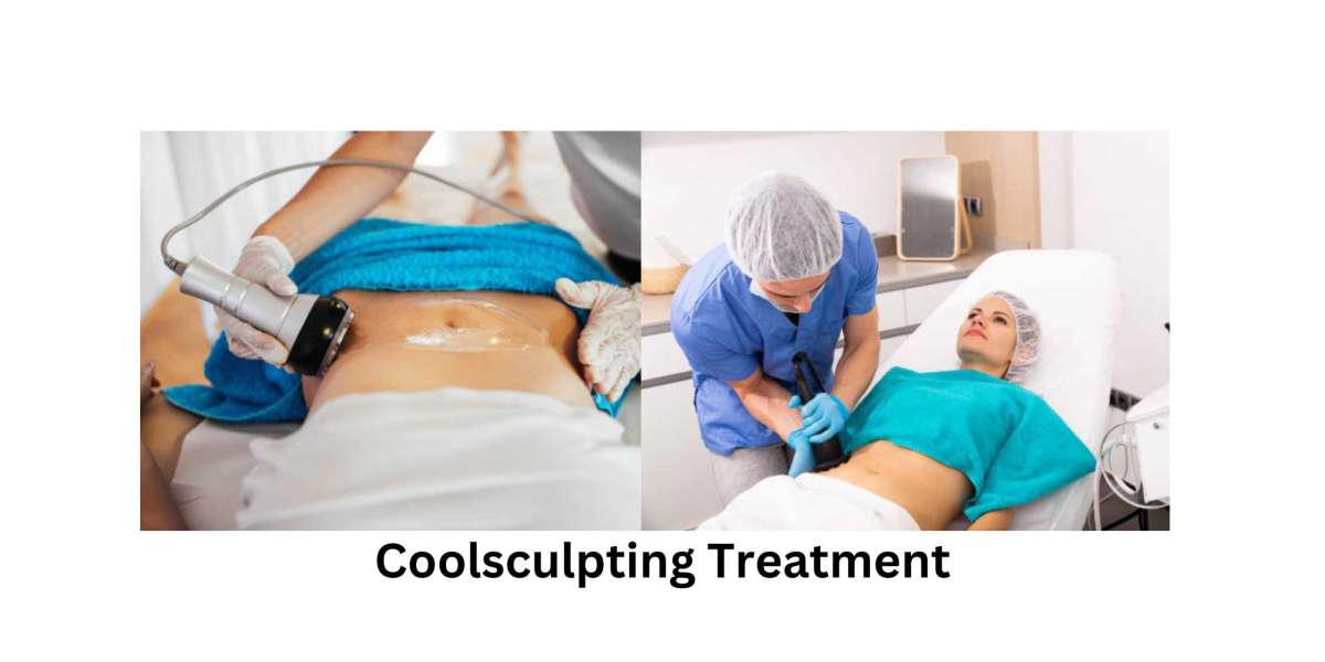 The Best CoolSculpting Treatments for Maximum Results