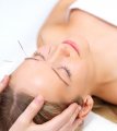 Holistic Healing with Acupuncture Treatment and Cupping Therapy - Jayanth Clinic