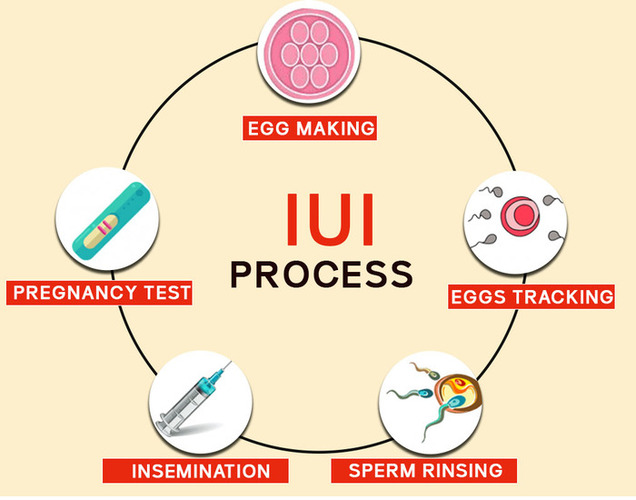 IVF Treatment in Delhi NCR | Best IUI Treatment Specialist In New Delhi, Best IUI Treatment Center In South Delhi| Dr. Rupali Bassi